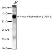 Pituitary homeobox 2 (PITX2) Rabbit mAb