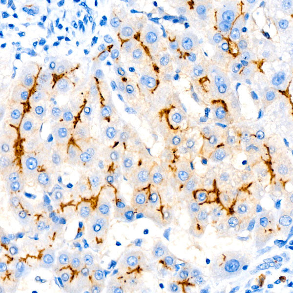 CD10/MME Rabbit mAb