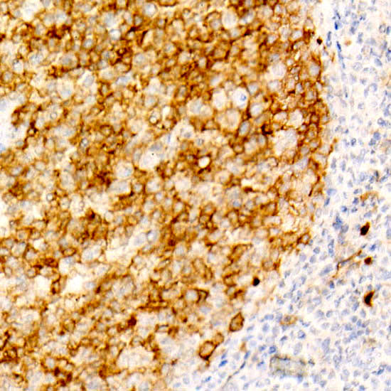 CD10/MME Rabbit mAb