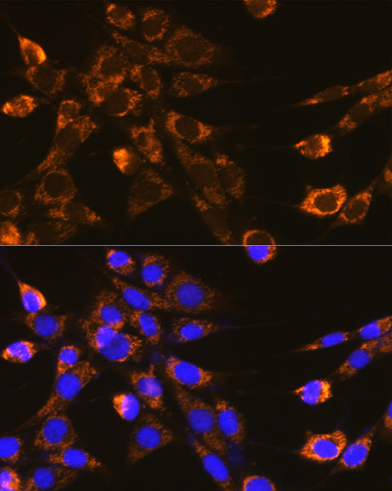 Integrin-β1/CD29 Rabbit pAb