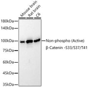 [KO Validated] Non-phospho (Active)β-Catenin -S33/S37/T41 Rabbit mAb