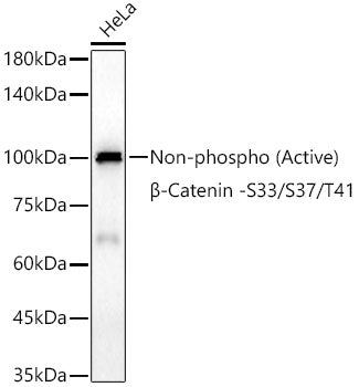 [KO Validated] Non-phospho (Active)β-Catenin -S33/S37/T41 Rabbit mAb