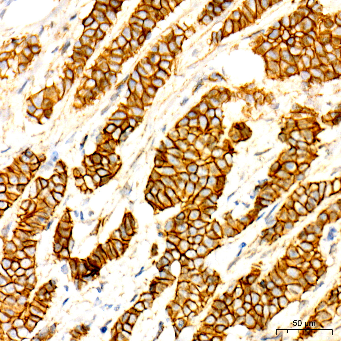 [KO Validated] Non-phospho (Active)β-Catenin -S33/S37/T41 Rabbit mAb