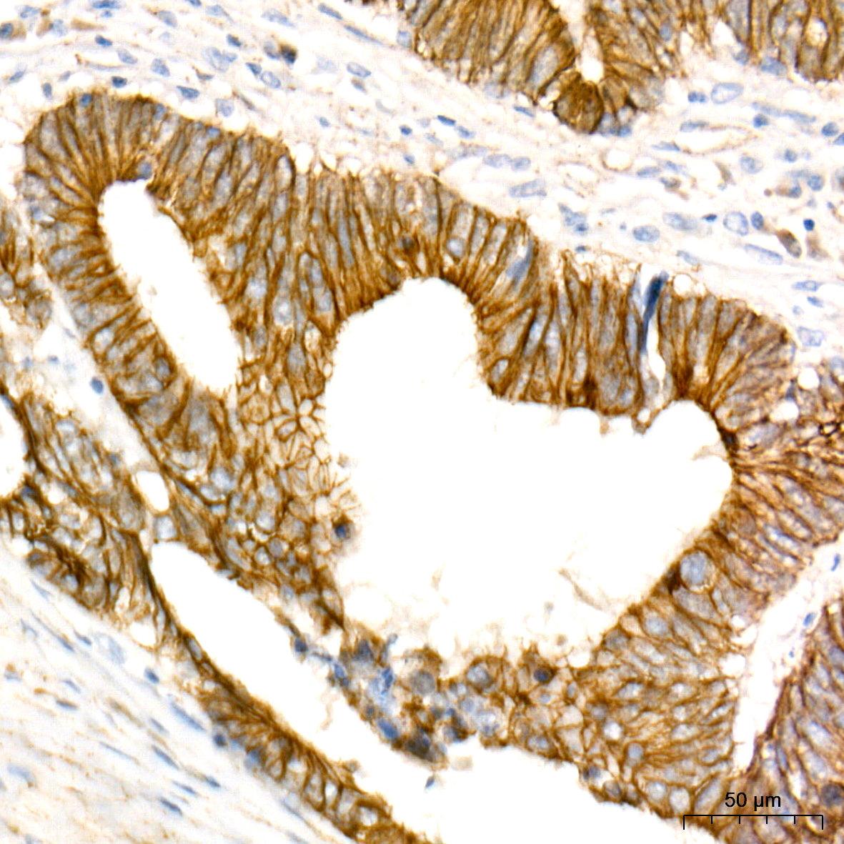 [KO Validated] Non-phospho (Active)β-Catenin -S33/S37/T41 Rabbit mAb