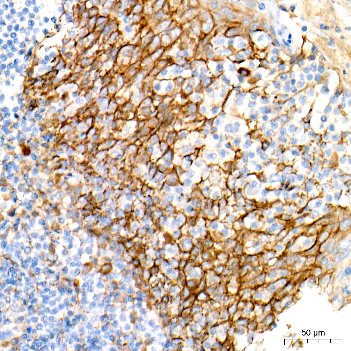 [KO Validated] Non-phospho (Active)β-Catenin -S33/S37/T41 Rabbit mAb