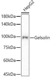 [KD Validated] Gelsolin Rabbit mAb