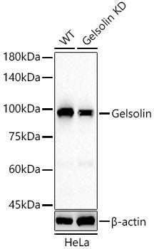 [KD Validated] Gelsolin Rabbit mAb