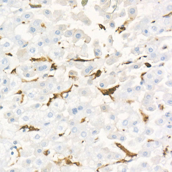 [KD Validated] Gelsolin Rabbit mAb