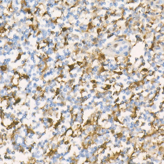 [KD Validated] Gelsolin Rabbit mAb