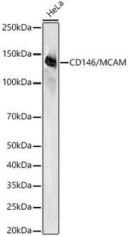 CD146/MCAM Rabbit mAb