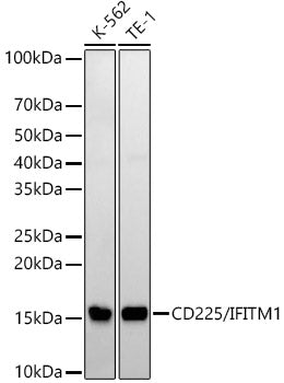CD225/IFITM1 Rabbit mAb