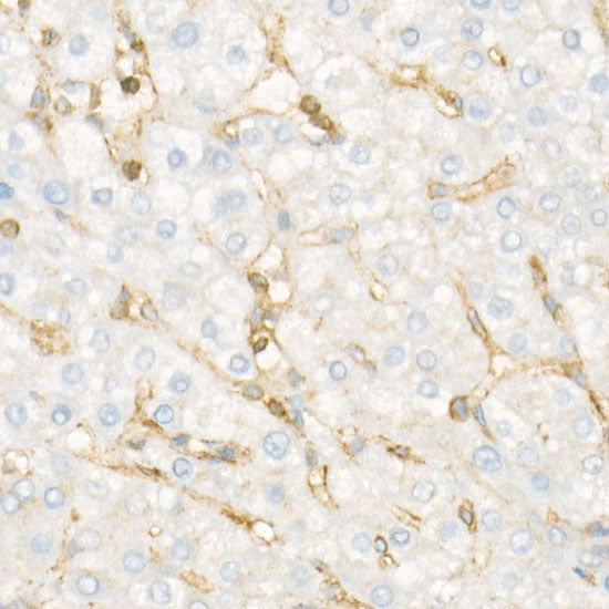 CD225/IFITM1 Rabbit mAb