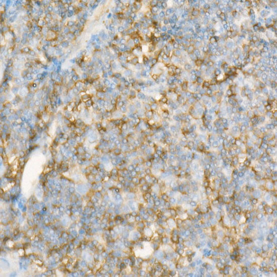 CD225/IFITM1 Rabbit mAb