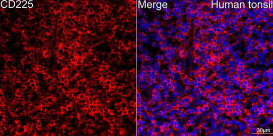 CD225/IFITM1 Rabbit mAb