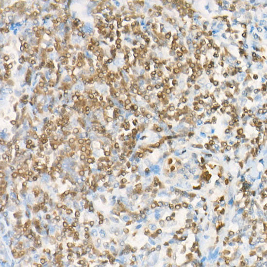 DGKA Rabbit mAb