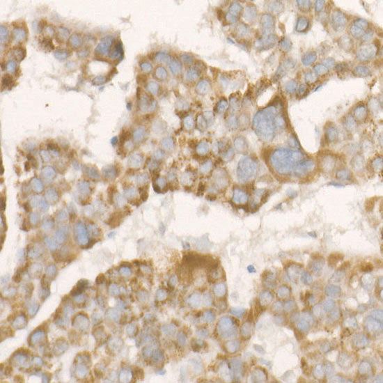PGAM5 Rabbit mAb