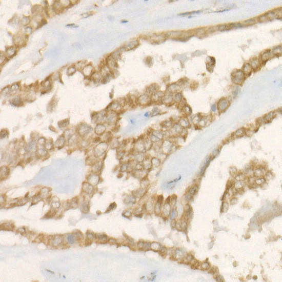 PGAM5 Rabbit mAb
