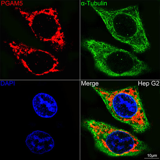 PGAM5 Rabbit mAb