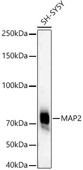 MAP2 Rabbit mAb