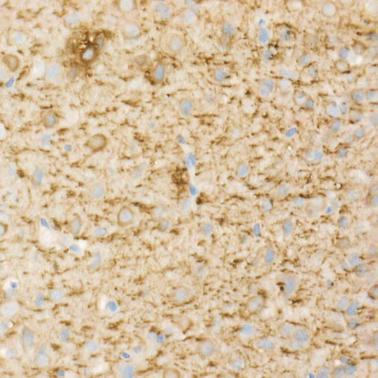 MAP2 Rabbit mAb