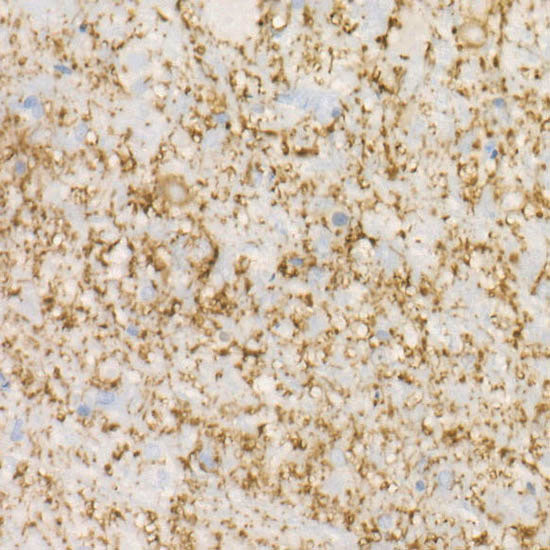 MAP2 Rabbit mAb