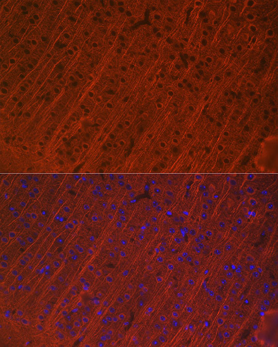MAP2 Rabbit mAb
