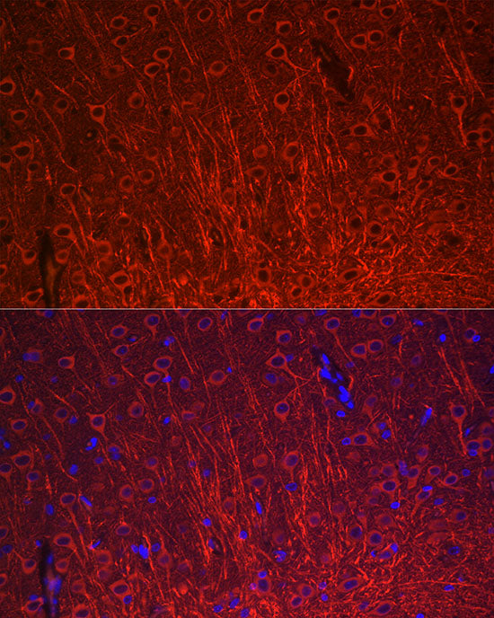 MAP2 Rabbit mAb