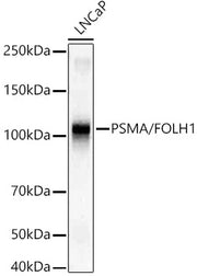 PSMA/FOLH1 Rabbit mAb