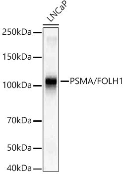 PSMA/FOLH1 Rabbit mAb
