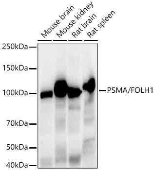 PSMA/FOLH1 Rabbit mAb