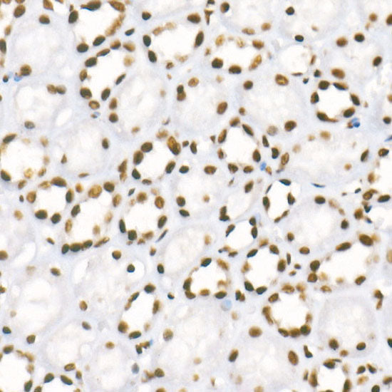 TriMethyl-Histone H3-K4 Rabbit mAb