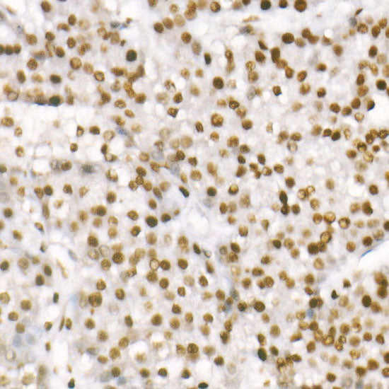 TriMethyl-Histone H3-K4 Rabbit mAb
