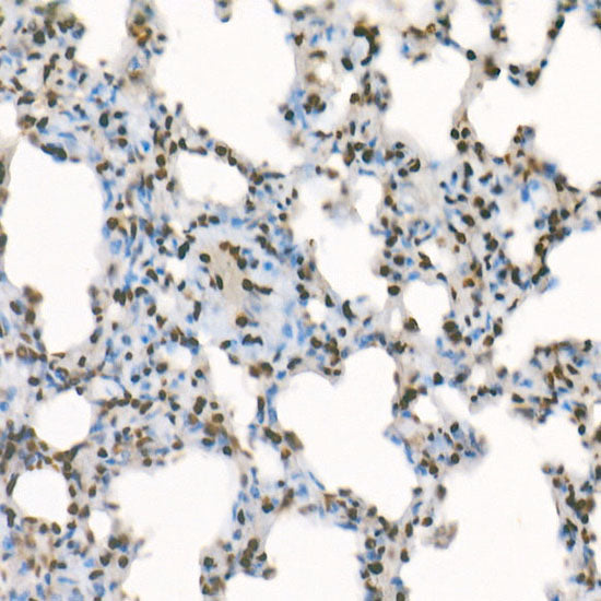 TriMethyl-Histone H3-K4 Rabbit mAb