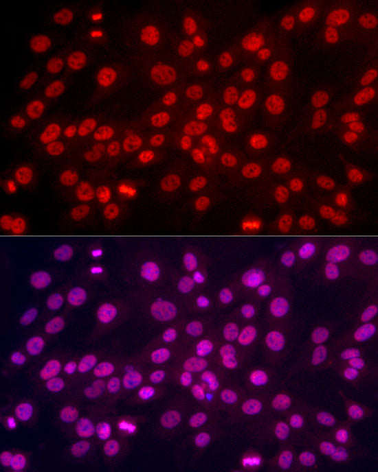 TriMethyl-Histone H3-K4 Rabbit mAb