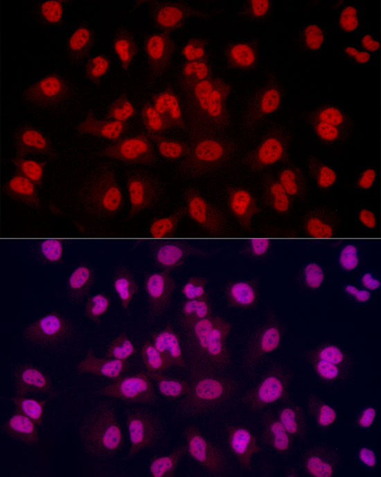 TriMethyl-Histone H3-K4 Rabbit mAb