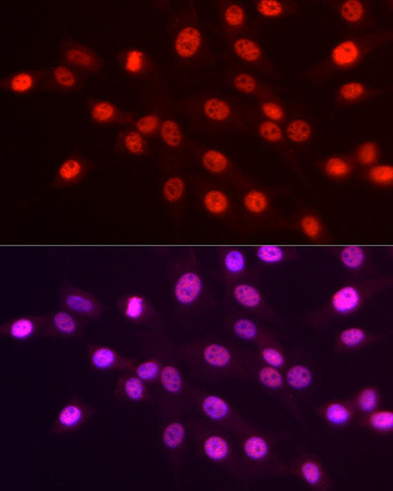 TriMethyl-Histone H3-K4 Rabbit mAb