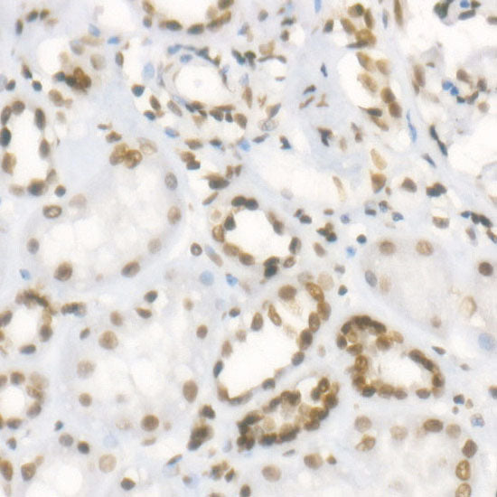 TriMethyl-Histone H3-K4 Rabbit mAb