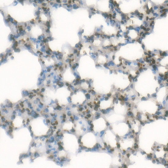 TriMethyl-Histone H3-K4 Rabbit mAb