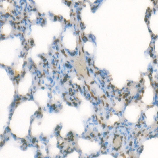 TriMethyl-Histone H3-K4 Rabbit mAb