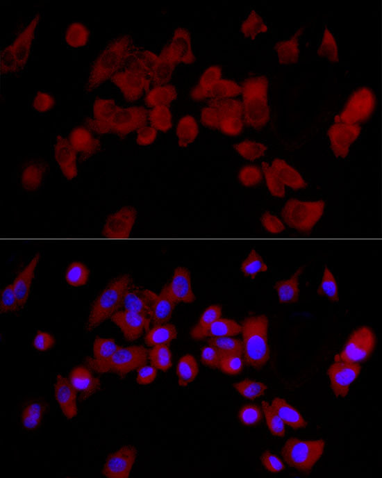 CYP3A4 Rabbit mAb