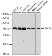 CPSF73 Rabbit mAb