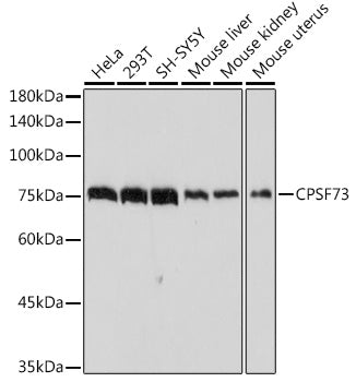 CPSF73 Rabbit mAb