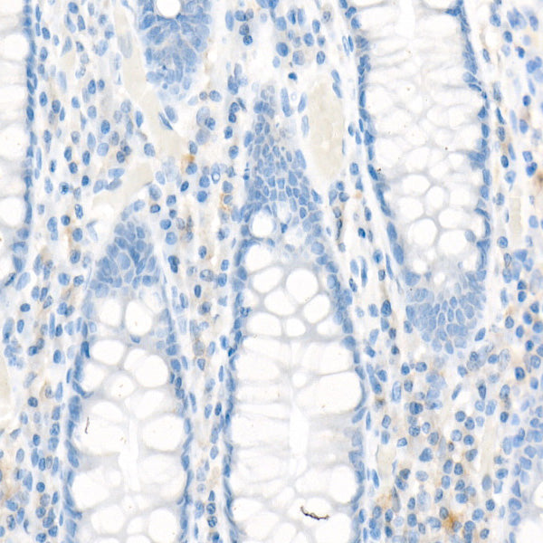 MRP1/ABCC1 Rabbit mAb