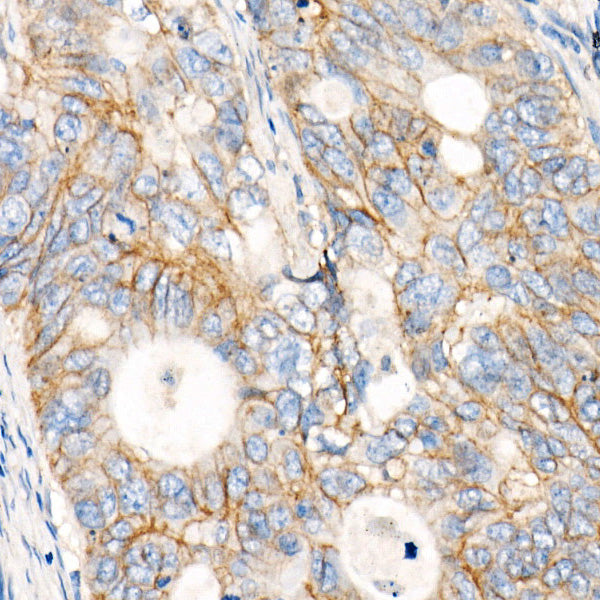 MRP1/ABCC1 Rabbit mAb