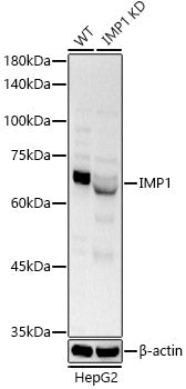 [KO Validated] IGF2BP1/IMP1 Rabbit pAb