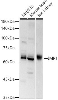 [KO Validated] IGF2BP1/IMP1 Rabbit pAb