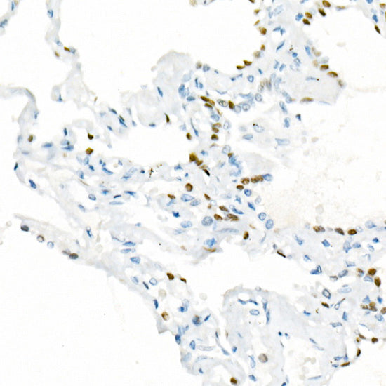 NKX2-1 Rabbit mAb