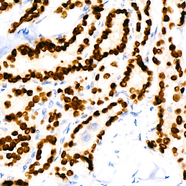 NKX2-1 Rabbit mAb