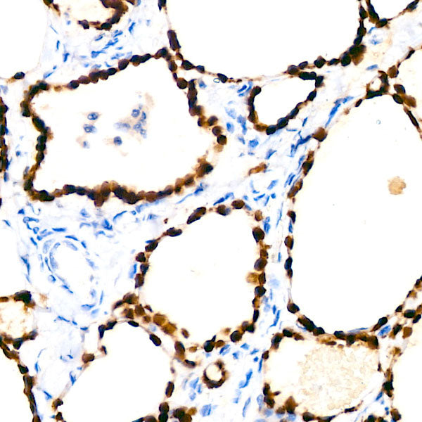 NKX2-1 Rabbit mAb