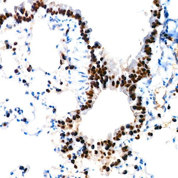NKX2-1 Rabbit mAb